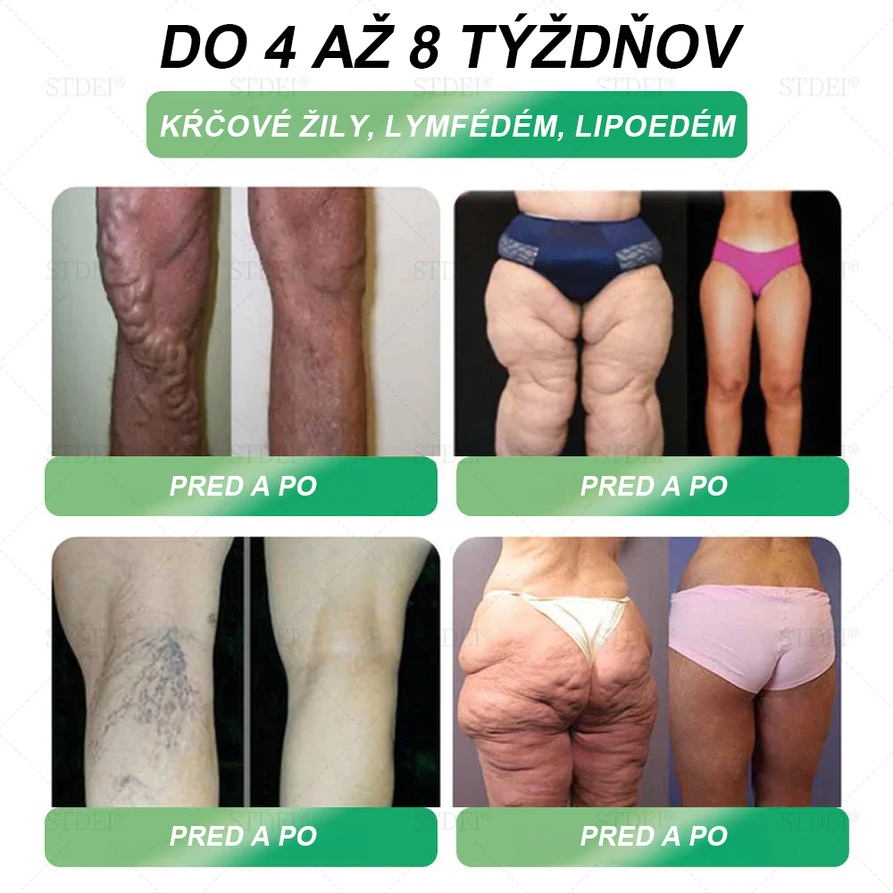 Odporúčané klinikou Mayo | Oficiálny obchod 👨⚕️STDEI® GLP-1 Perorálny roztok na chudnutie💥Obezita, kardiovaskulárne ochorenia, cukrovka, spánkové apnoe, problémy s kĺbmi a ďalšie