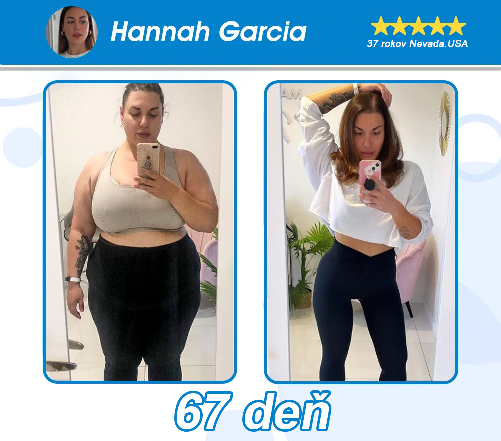 Oficiálny autorizovaný obchod PEAKA® GLP-1 Slimming & Health Ultra Concentrated Essence Liquid Pearls - NAD+ Moringa & ACV & Keto BHB (✅rýchly, dlhotrvajúci účinok, riešenie cukrovky, obezity a kardiovaskulárnych ochorení)