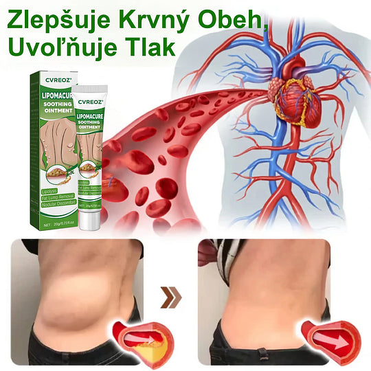 Cvreoz® Upokojujúca masť na lipómy €28.00 €50.00 -€22.00