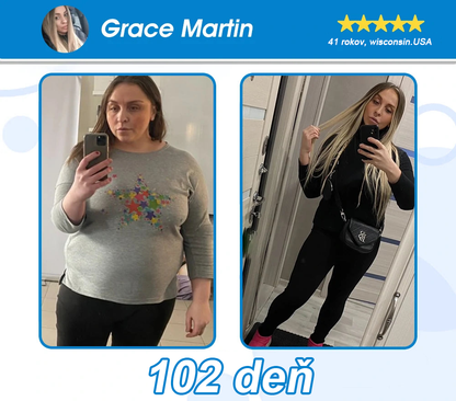 Oficiálny autorizovaný obchod PEAKA® GLP-1 Slimming & Health Ultra Concentrated Essence Liquid Pearls - NAD+ Moringa & ACV & Keto BHB (✅rýchly, dlhotrvajúci účinok, riešenie cukrovky, obezity a kardiovaskulárnych ochorení)