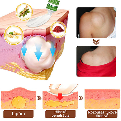 Cvreoz® Upokojujúca masť na lipómy €28.00 €50.00 -€22.00