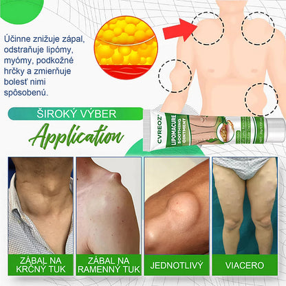 Cvreoz® Upokojujúca masť na lipómy €28.00 €50.00 -€22.00